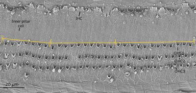 Ultrastructure of the organ of Corti in harbor seals (Phoca vitulina)